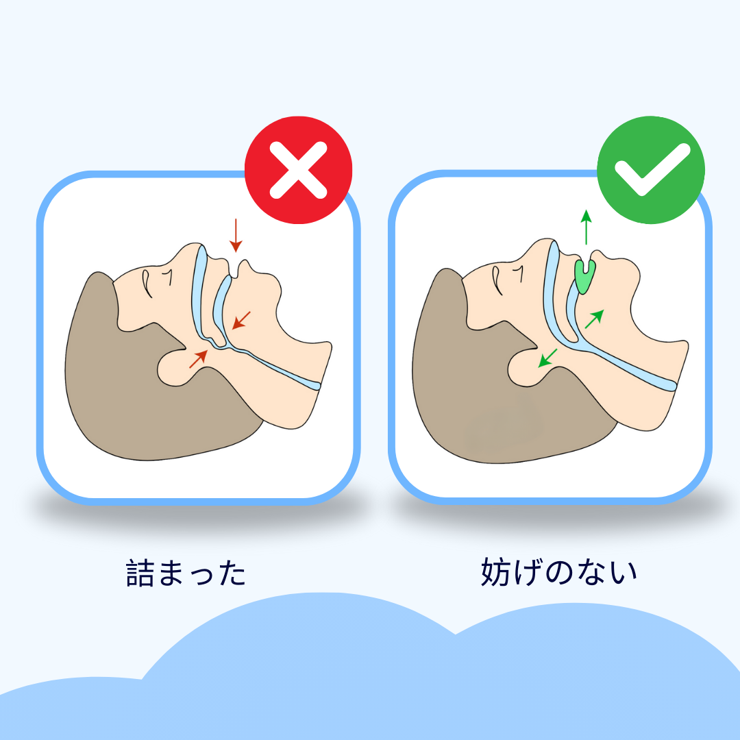 Silent PRO いびき対策用